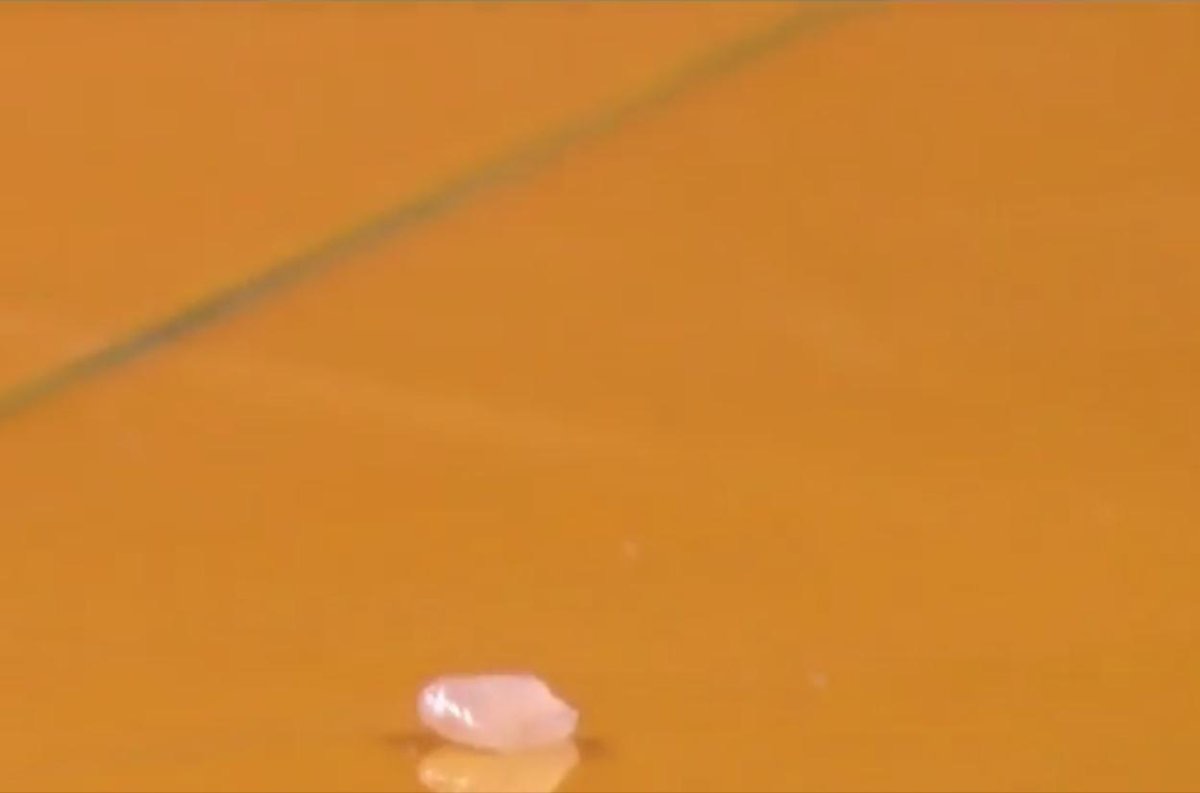 PHOTO: Fred VanVleet’s Tooth Just Laying On The Floor