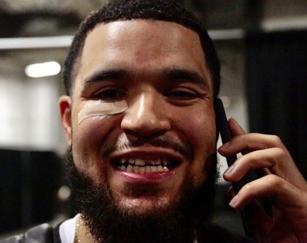 Priceless Photo Fred VanVleet On His Flip Phone In Arena Smiling With A Chipped Front Tooth And Band Aid Under His Eye