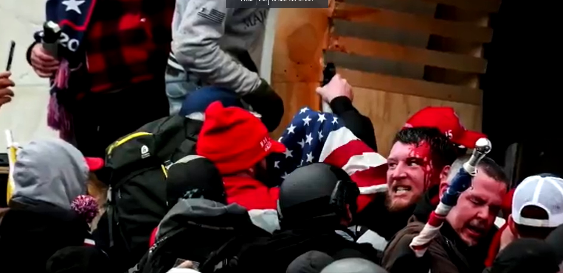 PHOTO Trump Supporter Bleeding After Police Fired Gun In Crowd Outside Capitol