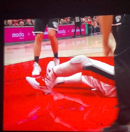 Jusuf Nurkic's Leg Hanging There Broken In Half Still Shot