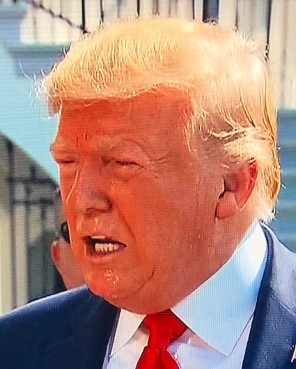 PHOTO Donald Trump's Face Looks Like He's Withdrawaling On Drug