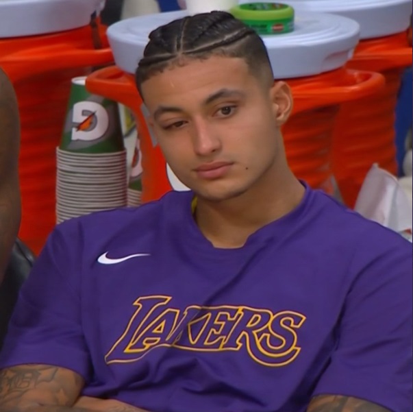 PHOTO Kyle Kuzma's Eye Is Swelling Over And Barely Open