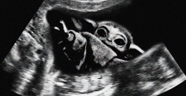 PHOTO Baby Yoda Showing Up On An X-Ray