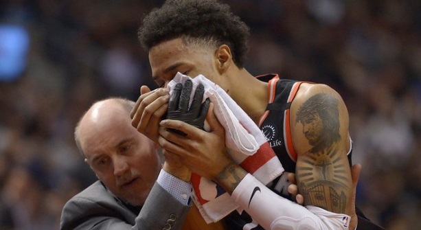 PHOTO Patrick McCaw's Broken Nose