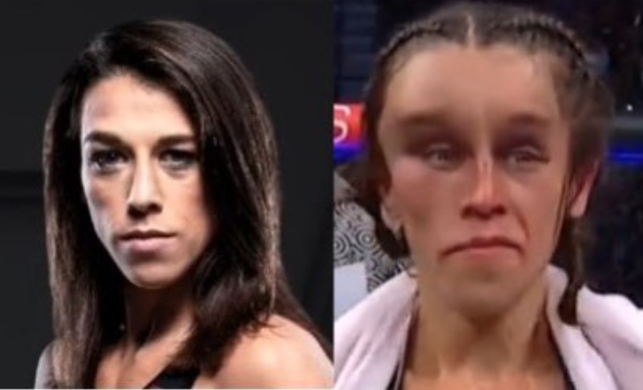 PHOTO Joanna's Face Flattened After UFC Match