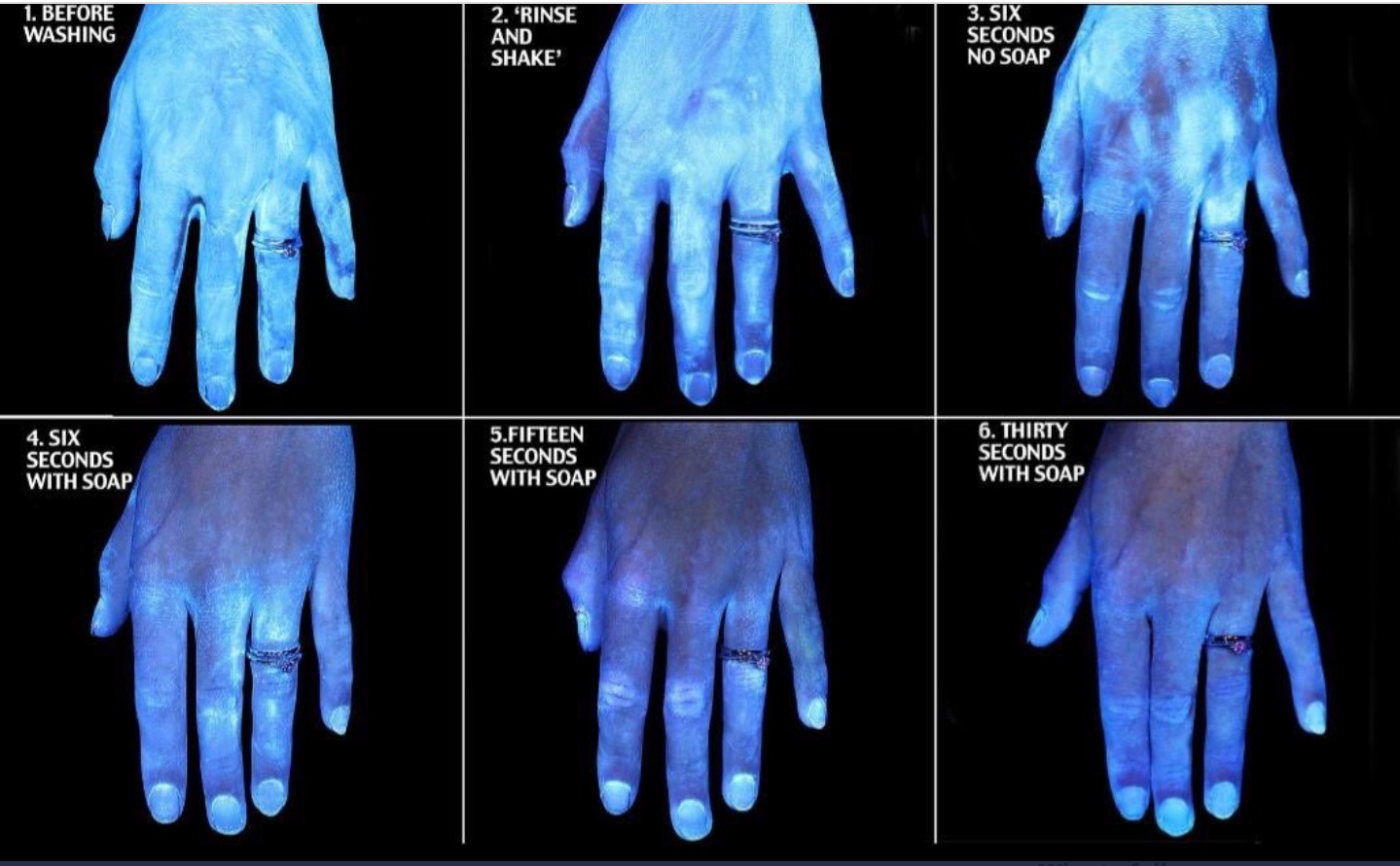 PHOTO What Your Hands Actually Look Like When You Wash Them To Stop Corona Virus Spread