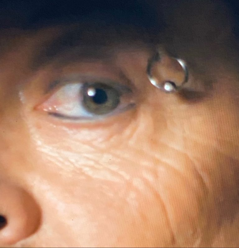 PHOTO Joe Exotic's Eyebrow Ring Hanging On For Dear Life