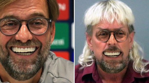 PHOTO Jürgen Klopp Looks Like Joe Exotic