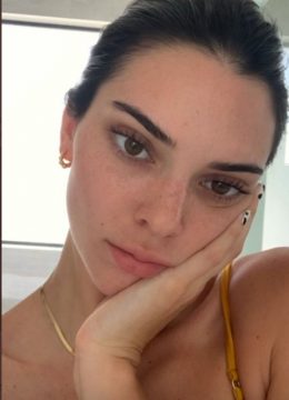 PHOTO Kendall Jenner's Skin Shows Imperfection And Is Pale When She's ...