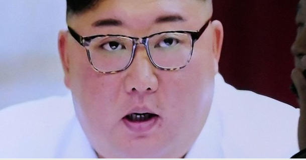 PHOTO King Jong Un Looking Brain Dead