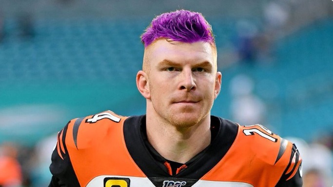 PHOTO Andy Dalton With Purple Hair