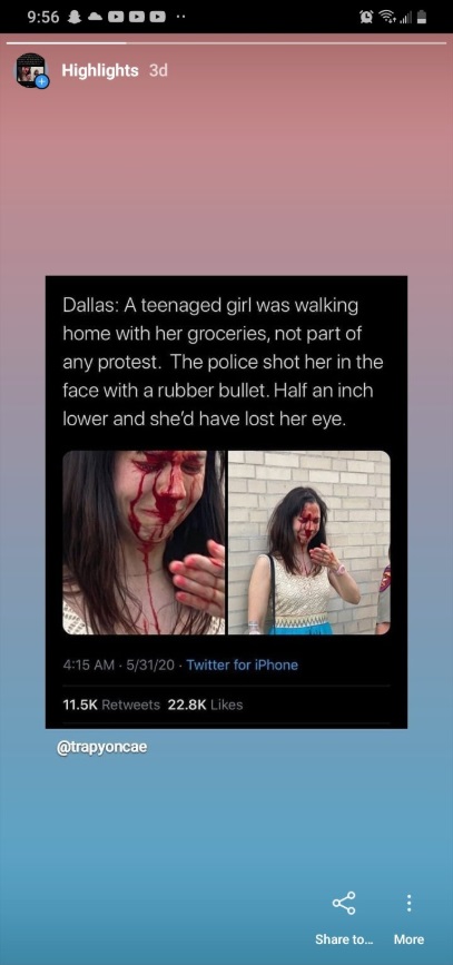 PHOTO Dallas Girl Hit In Eye With Rubber Bullet By Police While Not Protesting