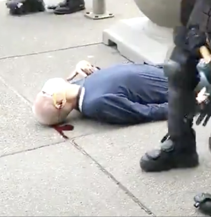 PHOTO Officer Torgalski Watches White Man Bleed From His Head On The Ground