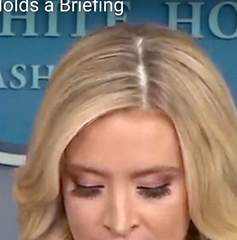 PHOTO Close Up Kayleigh McEnany's Skull Is So White It Looks Like She Bleaches It