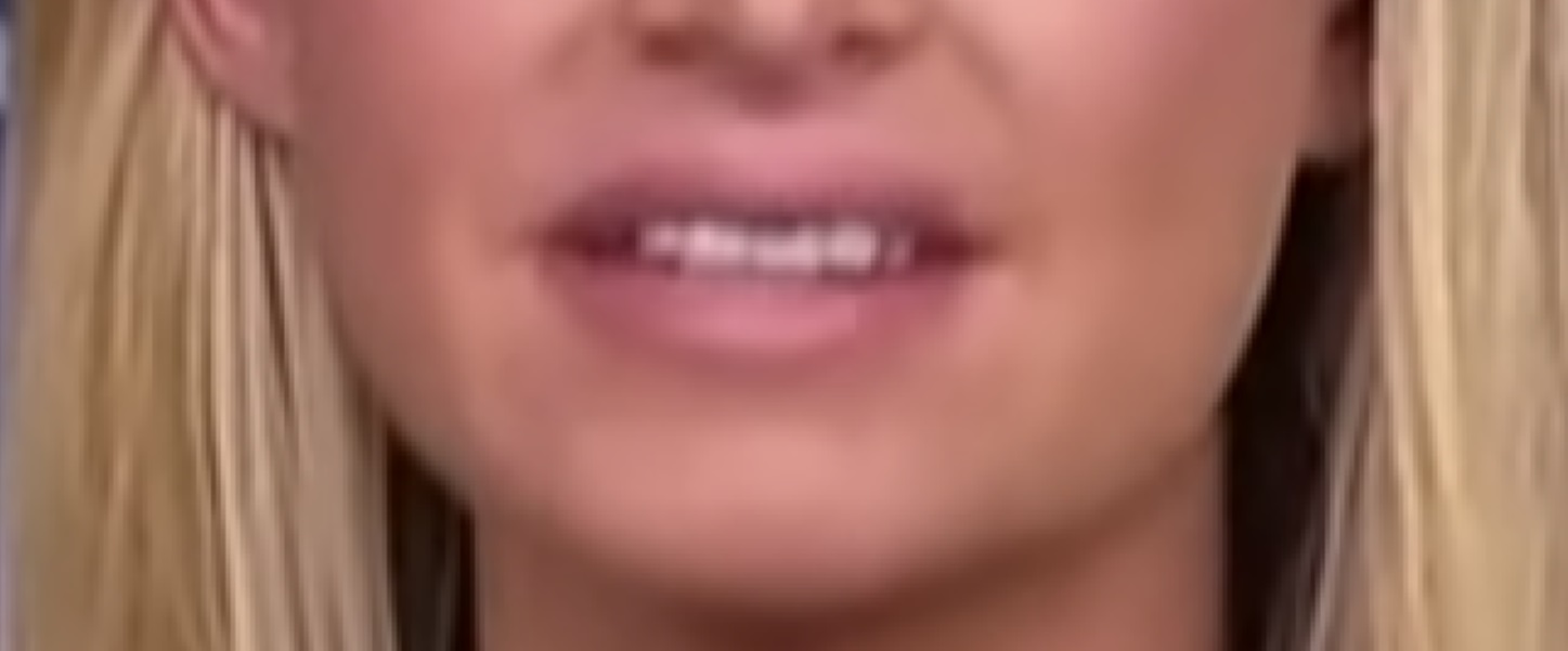 PHOTO Close Up Of Kayleigh McEnany's Teeth Show They're Not In The Best Shape