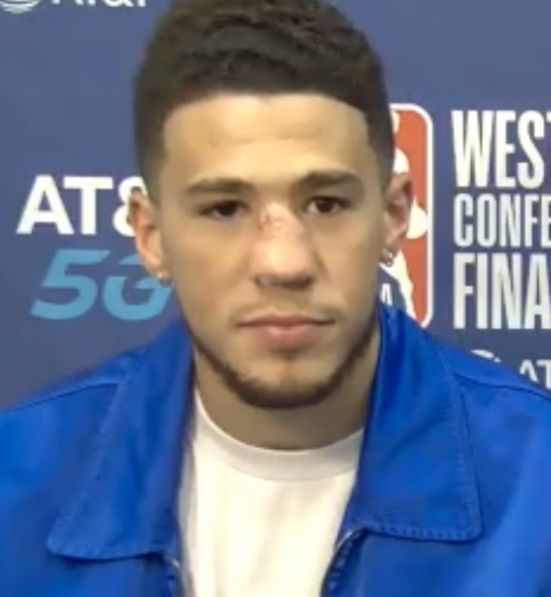 PHOTO Close Up Of Devin Booker's Crooked Nose