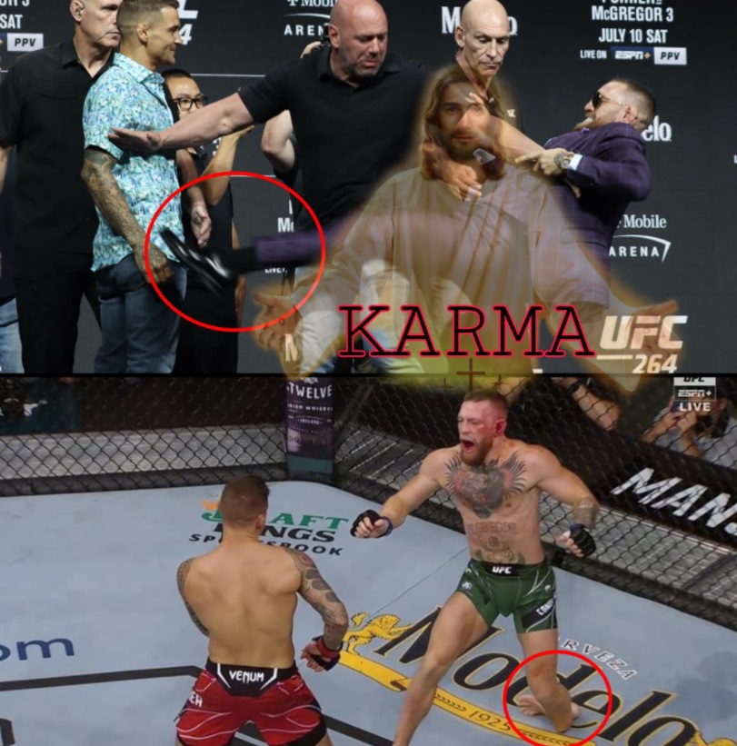 PHOTO Conor McGregor Karma For Kicking Poirier Pre-Fight