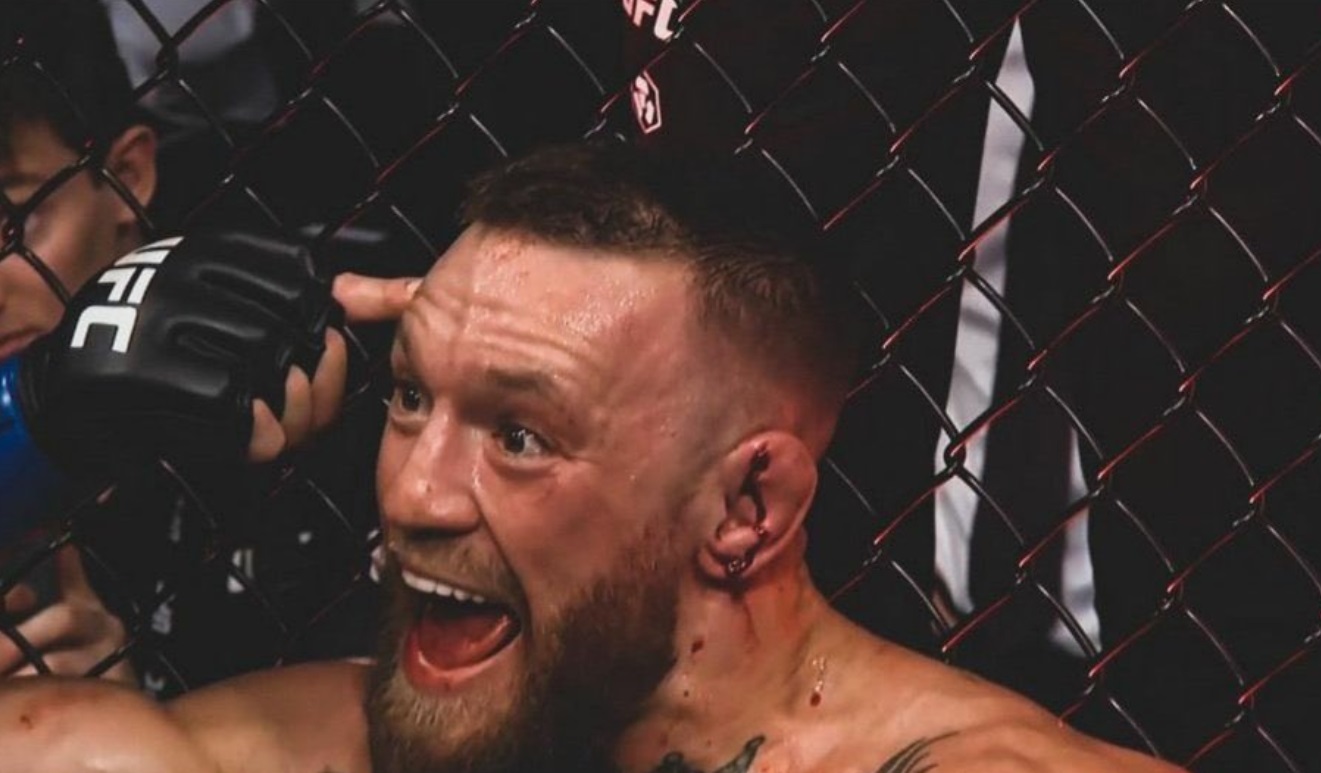 PHOTO Conor McGregor Pointing At His Head Like he Has An IQ Of 2