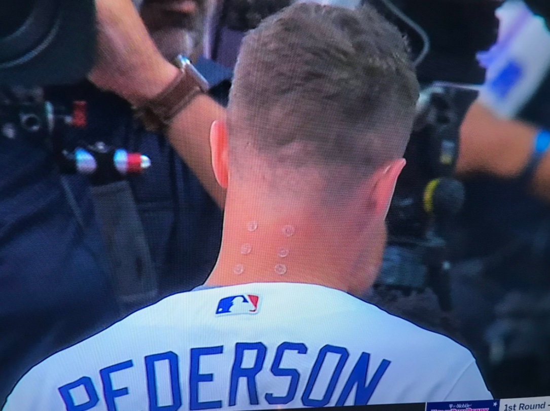 PHOTO Joc Peterson Has Marks On His Neck Like He's A Robot