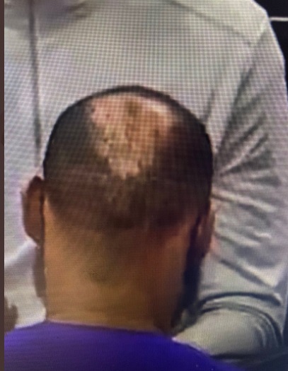 PHOTO Lebron's Scalp Doesn't Even Look Like He's Balding It's More Like His Hair Is Just Missing