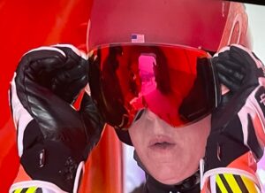 PHOTO Close Up Of Mikaela Shiffrin's Extremely Chapped Lips