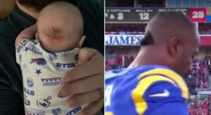 PHOTO What To Look For If Your Baby Has The Von Miller Patch