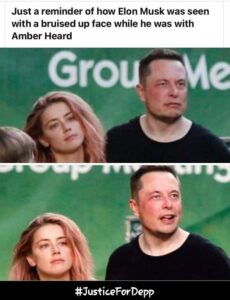 PHOTO Elon Musk With Bruised Up Face While He Was With Amber Heard Justice For Johnny