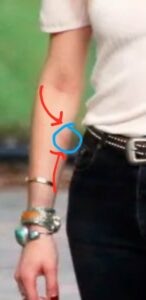 PHOTO The Size Of The Bruise On Amber Heard's Left Arm While Holding Hands With Elon Musk Is Concerning