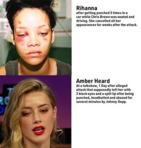 PHOTO Amber Heard Face Abuse Vs Rihanna Real Abuse