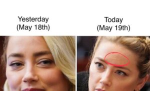 PHOTO Amber Heard Had No Marks On Her Forehead On May 18th Then Randomly The Next Day May 19th She Had What Looked Like A Scar Across Her Forehead
