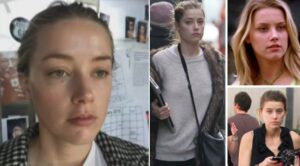 PHOTO Amber Heard Paparazzi Photos Vs When She Got Pummeled And Headbutted With Broken Nose Two Black Eyes It Just Doesn't Add Up