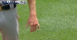 PHOTO Close Up Of Chris Sale's Broken Finger Just Hanging There Will Make You Vomit
