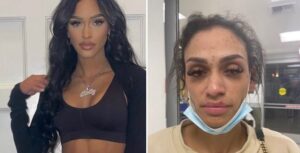 PHOTO Miles Bridges Wife Wearing Makeup Before And After He Beat Her Up It Looks Like A Miracle That She's The Same Person In Both Comparions Pictures