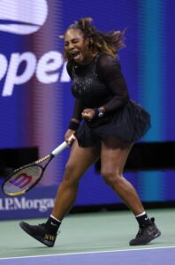 PHOTO Serena Williams' Legs Are Built Like Goliath