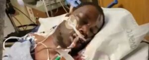 PHOTO Of Tyre Nichols Hooked Up To Machine While He Was Fighting For His Life In The Hospital