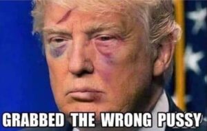 PHOTO Grabbed The Wrong P*ssy Donald Trump With Bruises On His Face Meme