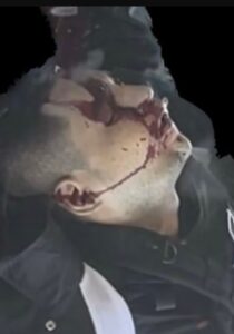 PHOTO Mauricio Garcia's Head Was All Bloody After Being Taken Down By Law Enforcement