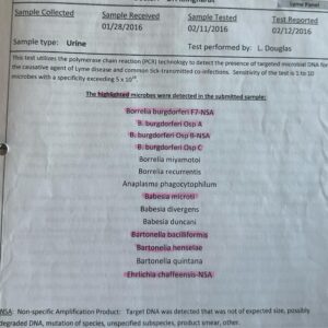 PHOTO Of Bella Hadid's Test Results Showing Diagnoses Found By Testing