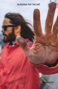 PHOTO Jared Leto's Hand Bruisd Bleeding And Cut Up From Climbing Empire State Building