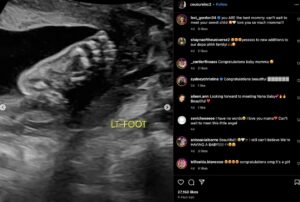 PHOTO Anthony Edwards' Girlfriend Shows Scan Of Baby