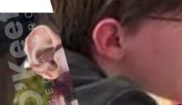 PHOTO Thomas Matthew Crooks Ear Matches Ear Of Body Recovered On Roof