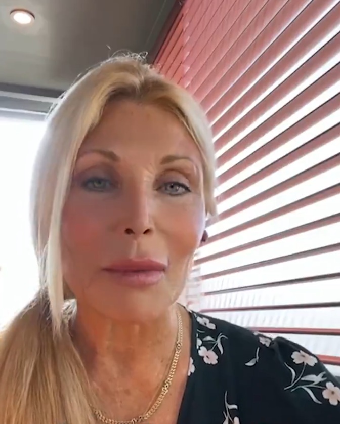 photo-pamela-bach-had-terrible-plastic-surgery