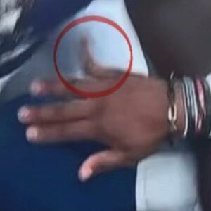 PHOTO Anthony Richardson’s Right Pinky Pointing At A 90 Degree Angle