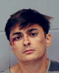 PHOTO Ethan Nieneker All Bloody In His Mugshot