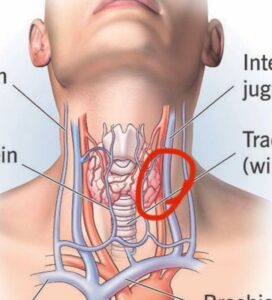 PHOTO Proof Charlie Kirk Was Shot Directly In Major Blood Vessel